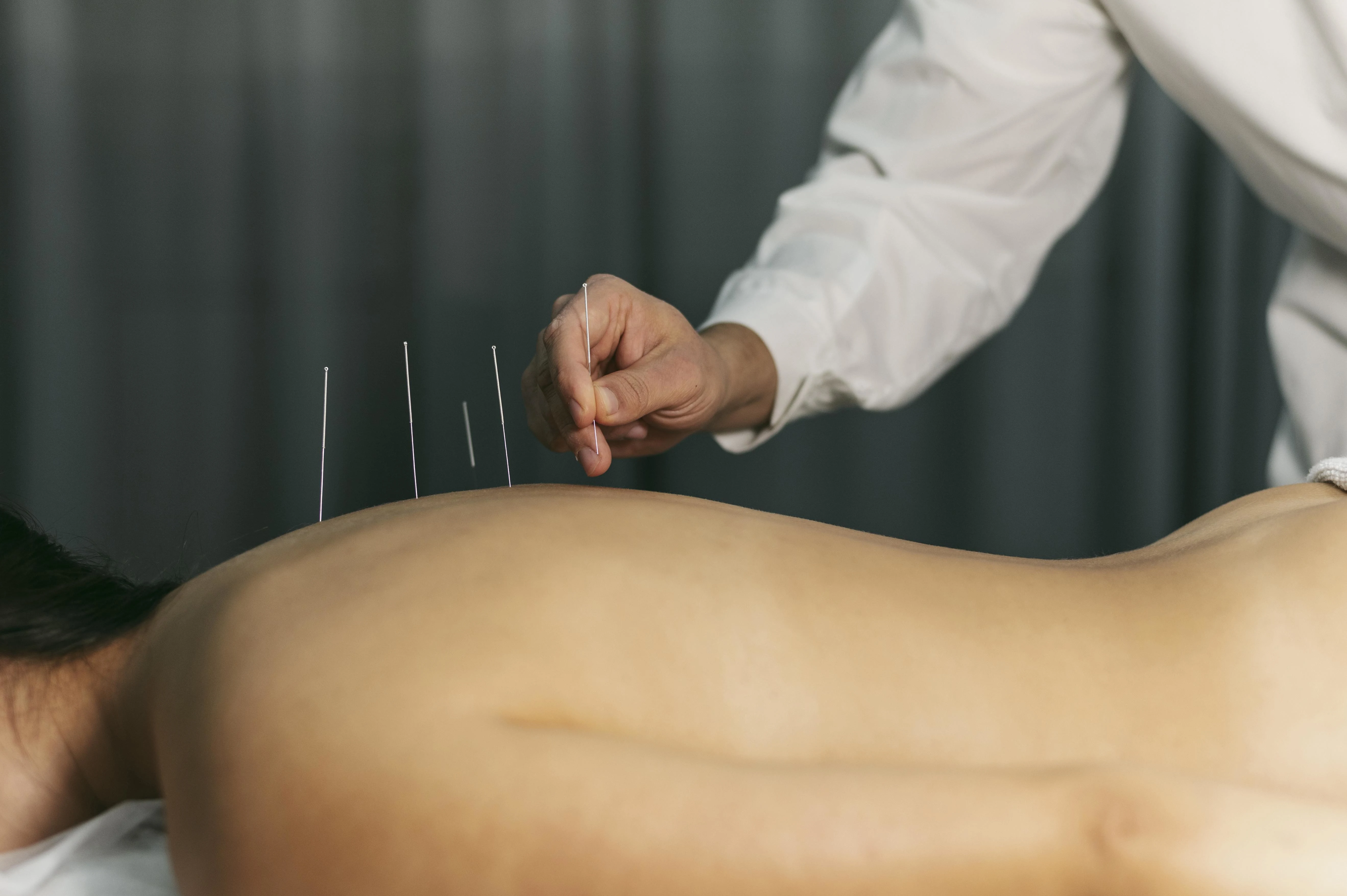 Chinese meridian therapy session balancing the body's energy lines