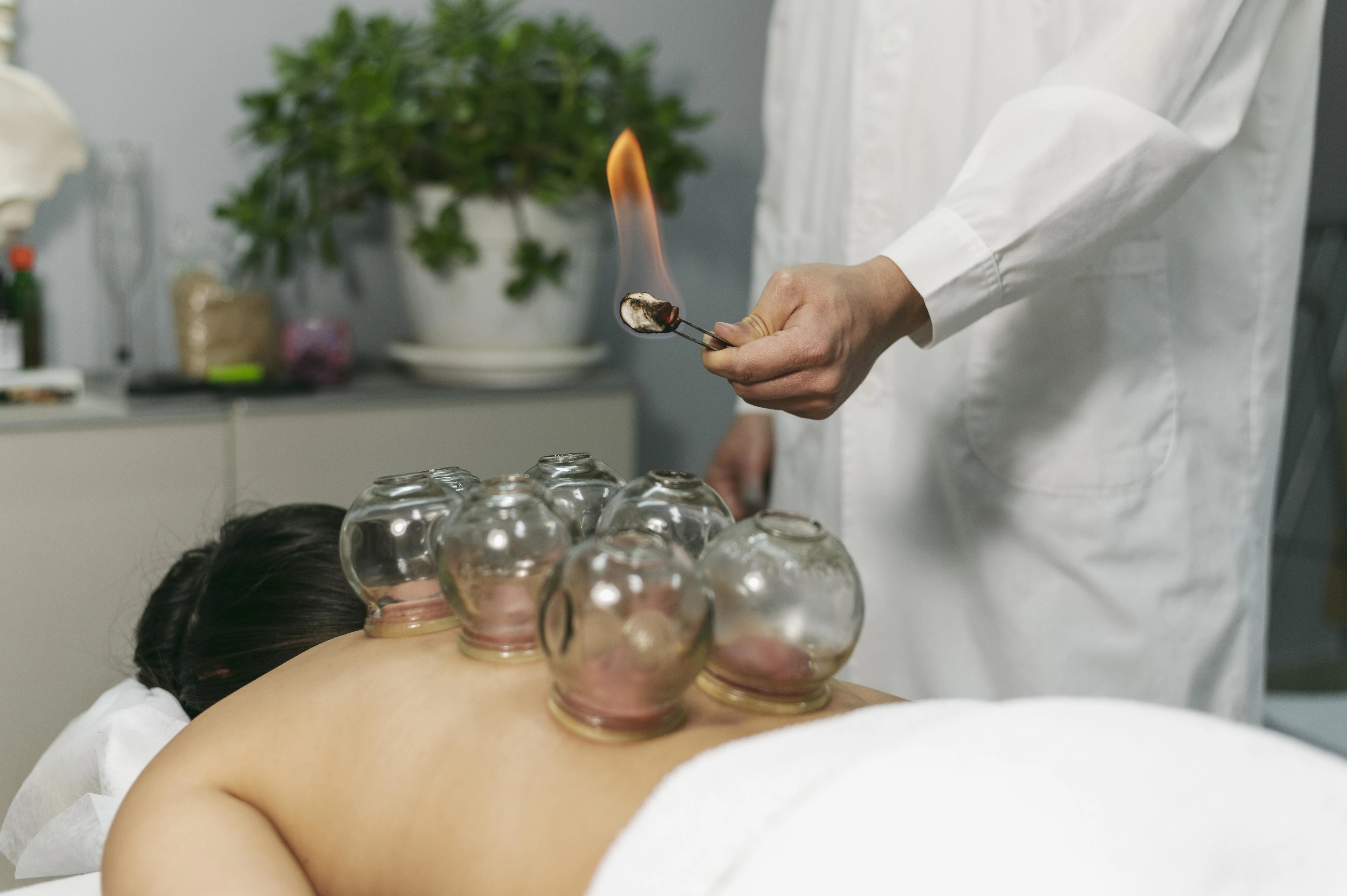 Hijamah Therapy session